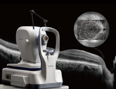 新一代莫廷光学相干断层扫描仪Mocean 4000，为眼病患者